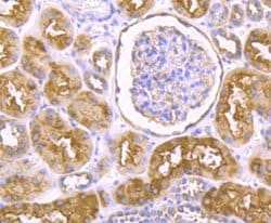 IKK epsilon/IKBKE Rabbit anti-Human, Clone: JU06-72, Novus Biologicals