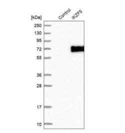 IKZF5 Antibody, Novus Biologicals 25 &mu;L | Buy Online | Novus Biologicals | Fisher Scientific