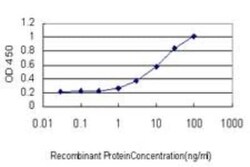 IL1RAPL1 Antibody (1C10), Novus Biologicals 0.1 mg | Buy Online | Novus Biologicals | Fisher Scientific