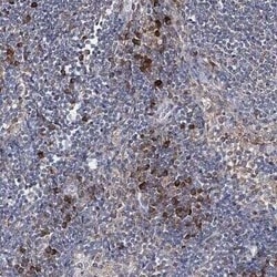 IL-1 RAcP/IL-1 R3 Antibody, Novus Biologicals 0.1 mL; Unconjugated:Antibodies,