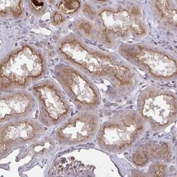 IL-1 RI Antibody, Novus Biologicals:Antibodies:Primary Antibodies