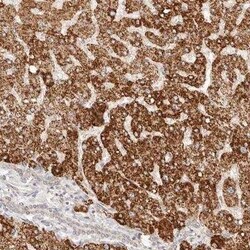 IL-1 RII Antibody, Novus Biologicals 0.1 mL | Buy Online | Novus Biologicals | Fisher Scientific