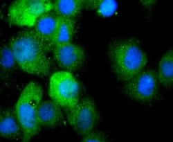 IL-1 beta/IL-1F2 Antibody (JJ087-3), Novus Biologicals 100&mu;L:Antibodies,