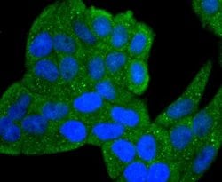 IL-1 beta/IL-1F2 Antibody (JJ087-3), Novus Biologicals 100&mu;L:Antibodies,