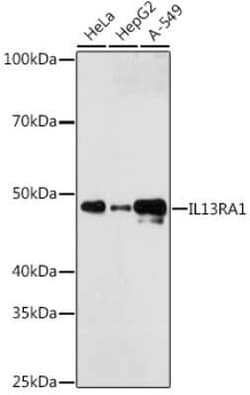 IL-13R alpha 1 Rabbit anti-Human, Clone: 5A3W5, Novus Biologicals 100 &mu;g | Buy Online | Novus Biologicals | Fisher Scientific
