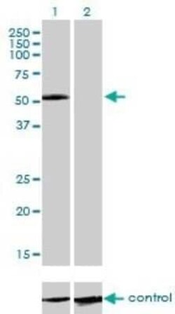 IL-13R alpha 2 Antibody (2E10), Novus Biologicals 0.1 mg | Buy Online | Novus Biologicals | Fisher Scientific