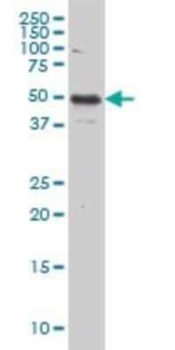 IL-13R alpha 2 Antibody (2E10), Novus Biologicals 0.1 mg | Buy Online | Novus Biologicals | Fisher Scientific