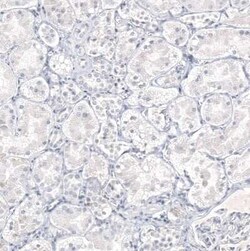 IL-17/IL-17A Antibody (CL10252), Novus Biologicals:Antibodies:Primary Antibodies