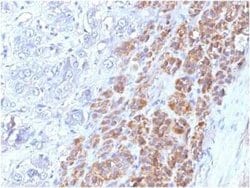 IL-17E/IL-25 Mouse anti-Human, Clone: IL25/625, Novus Biologicals 100 &mu;g;