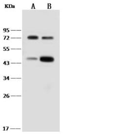 IL-18 R beta/IL-1 R7/ACPL Rabbit anti-Human, Clone: 290, Novus Biologicals:Antibodies:Primary