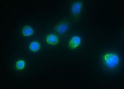 IL-1ra/IL-1F3/IL1RN Rabbit anti-Human, Clone: 4, Novus Biologicals 100 &mu;g | Buy Online | Novus Biologicals | Fisher Scientific