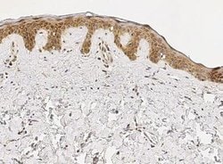 IL-1ra/IL-1F3/IL1RN Rabbit anti-Human, Clone: 5, Novus Biologicals:Antibodies:Primary