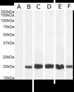IL-2, Rabbit anti-Human, Clone: LNKB-2, Novus Biologicals 0.2 mg; Unconjugated:Antibodies,