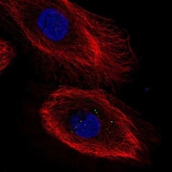 IL-20 R beta/FNDC6 Antibody, Novus Biologicals:Antibodies:Primary Antibodies