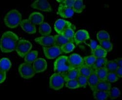 IL-31, Mouse anti-Human, Clone: 8-C3, Novus Biologicals 100 uL; Unconjugated:Antibodies,