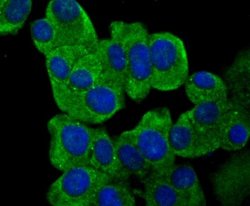 IL-31, Mouse anti-Human, Clone: 8-C3, Novus Biologicals 100 uL; Unconjugated:Antibodies,