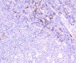 IL-31, Mouse anti-Human, Clone: 8-C3, Novus Biologicals 100 uL; Unconjugated:Antibodies,
