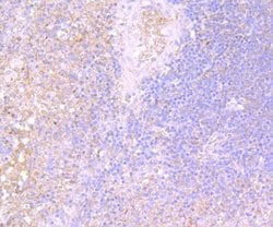 IL-31, Mouse anti-Human, Clone: 8-C3, Novus Biologicals 100 uL; Unconjugated:Antibodies,