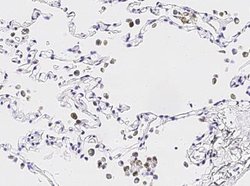 IL-36 gamma/IL-1F9 Rabbit anti-Human, Clone: 13, Novus Biologicals 50 &mu;g;