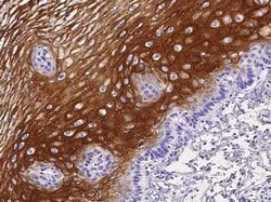 IL-36 gamma/IL-1F9 Rabbit anti-Human, Clone: 13, Novus Biologicals 50 &mu;g;