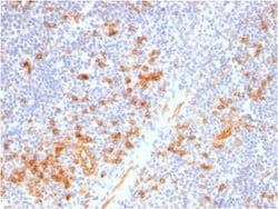 IL-3R alpha/CD123, Rabbit anti-Human, Clone: IL3RA/2947R, Novus Biologicals