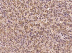 IL-40 Antibody, Novus Biologicals 50 &mu;g; Unconjugated:Antibodies, Polyclonal