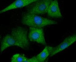 IL-6 Antibody (1-6), Novus Biologicals 100 &mu;L; Unconjugated:Antibodies,