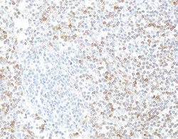 IL-7R alpha/CD127 Antibody (BLR177J), Novus Biologicals 100 &mu;g | Buy Online | Novus Biologicals | Fisher Scientific