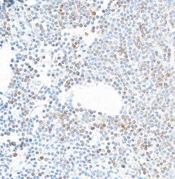 IL-7R alpha/CD127 Antibody (BLR177J), Novus Biologicals 100 &mu;g | Buy Online | Novus Biologicals | Fisher Scientific