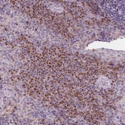 IL-9R Antibody, Novus Biologicals:Antibodies:Primary Antibodies