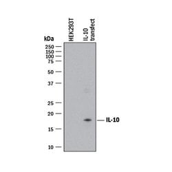Human IL-10 Antibody, R D Systems 25 ug; Unconjugated:Antibodies, Monoclonal