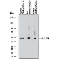 Human IL-11 R alpha Antibody, R D Systems:Antibodies:Primary Antibodies