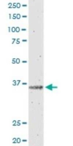 IL12B Antibody (2H6), Novus Biologicals 0.1 mg | Buy Online | Novus Biologicals | Fisher Scientific