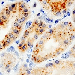 Human IL-15R alpha Antibody, R D Systems:Antibodies:Primary Antibodies