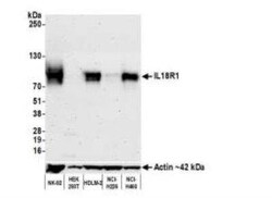 IL18R1 Antibody (BLR172J), Novus Biologicals 100 &mu;g | Buy Online | Novus Biologicals | Fisher Scientific
