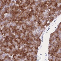 SF20/MYDGF Antibody, Novus Biologicals:Antibodies:Primary Antibodies
