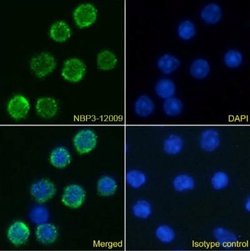 IL6R Rabbit anti-Mouse, Clone: D7715A7, Novus Biologicals 0.025 mg; Unconjugated:Antibodies,