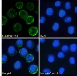 IL6R Antibody (rhPM-1 (Tocilizumab)) - Chimeric - Azide and BSA Free, Novus