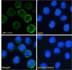 IL6R Antibody (rhPM-1 (Tocilizumab)) - Azide and BSA Free, Novus Biologicals