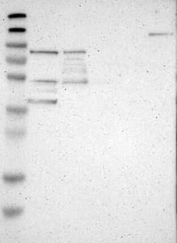 ILDR2 Rabbit anti-Human, Polyclonal, Novus Biologicals:Antibodies:Primary