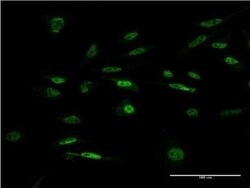 ILF1 Antibody (4A11), Novus Biologicals 0.1 mg | Buy Online | Novus Biologicals | Fisher Scientific