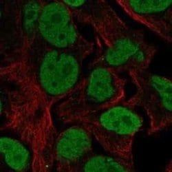 ILF1 Rabbit anti-Human, Polyclonal, Novus Biologicals 25 &mu;g; Unconjugated:Antibodies,