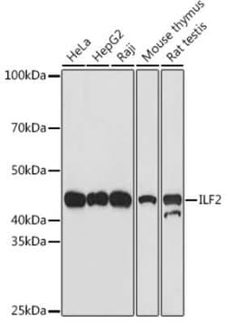 ILF2 Rabbit anti-Human, Mouse, Rat, Clone: 5P1K2, Novus Biologicals 20 &mu;g | Buy Online | Novus Biologicals | Fisher Scientific