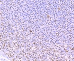 ILF2 Rabbit anti-Human, Mouse, Rat, Clone: JU50-33, Novus Biologicals 100