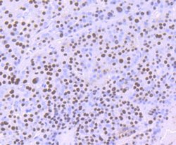 ILF2 Rabbit anti-Human, Mouse, Rat, Clone: JU50-33, Novus Biologicals 100