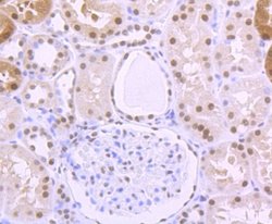 ILF2 Rabbit anti-Human, Mouse, Rat, Clone: JU50-33, Novus Biologicals 100