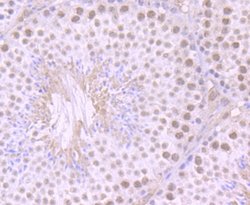 ILF2 Rabbit anti-Human, Mouse, Rat, Clone: JU50-33, Novus Biologicals 100