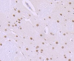ILF2 Rabbit anti-Human, Mouse, Rat, Clone: JU50-33, Novus Biologicals 100