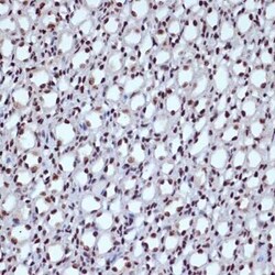 ILF3 Rabbit anti-Human, Mouse, Rat, Clone: 0S2N7, Novus Biologicals 100 &mu;g | Buy Online | Novus Biologicals | Fisher Scientific