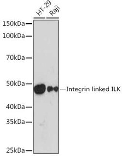 ILK Rabbit anti-Human, Mouse, Rat, Clone: 5R10U3, Novus Biologicals 20